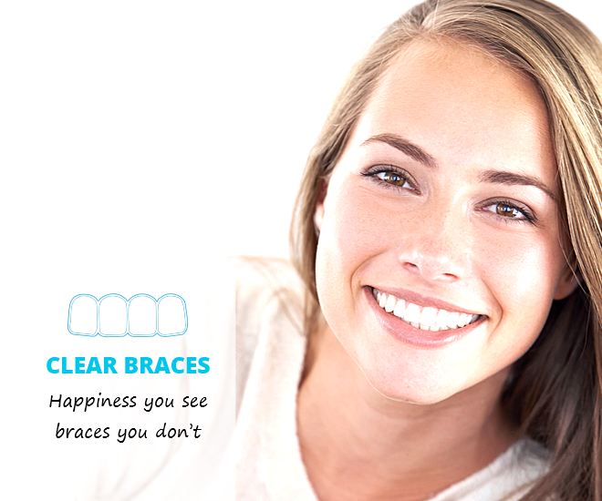 Admired clinic providing Clear dental braces for orthodontics treatments in Clacton on sea