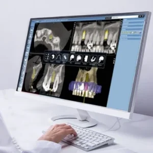 affordable 3D dental x ray and panoramic dental x ray in Clacton on sea