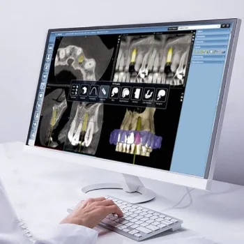 Dental Implant Planning using 3D X-ray at Admired clinic
