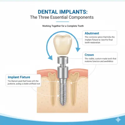 The 3 Essential Components of Dental Implants and Why They Matter